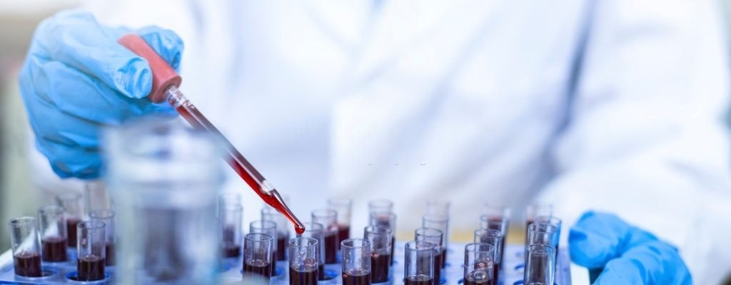 Scientist hand holding test tube with blood in laboratory. Scientist hand holding test tube with blood in laboratory.